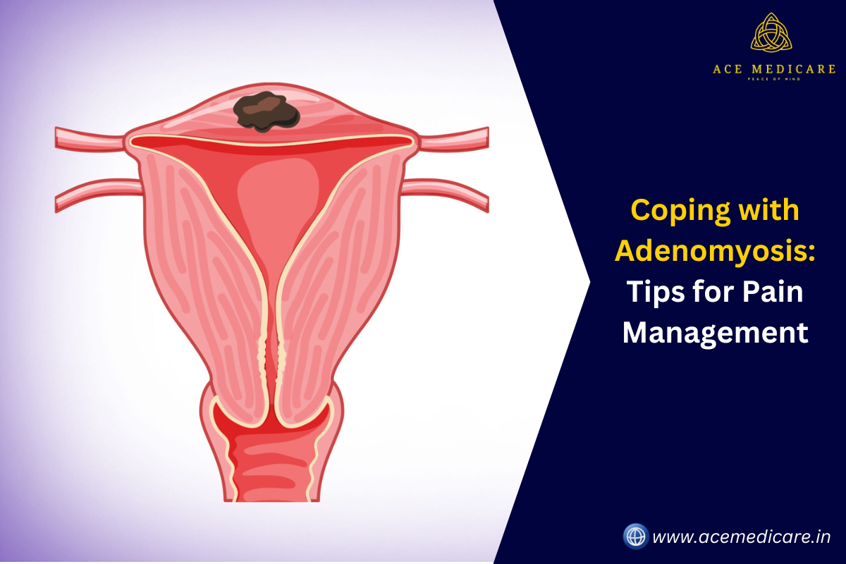Coping with Adenomyosis: Tips for Pain Management